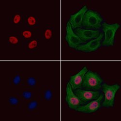 Invitrogen Phospho-PAX7 (Ser203) Polyclonal Antibody 100 &mu;L; Unconjugated:Antibodies,
