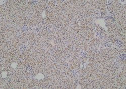 Phospho-LPIN1 (Thr14) Polyclonal Antibody 100 &mu;L | Buy Online | Invitrogen | Fisher Scientific