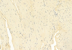 Invitrogen Phospho-RIP1 (Tyr384) Polyclonal Antibody 100 μL; Unconjugated:Antibodies,