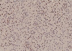 Invitrogen Phospho-BACH1 (Ser445) Polyclonal Antibody 100 &mu;L; Unconjugated:Antibodies,