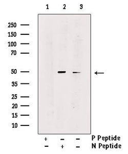 Invitrogen Phospho-SMYD2 (Ser283) Polyclonal Antibody 100 &mu;L; Unconjugated:Antibodies,