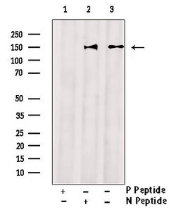 Invitrogen Phospho-ABCB11 (Ser690) Polyclonal Antibody 100 &mu;L; Unconjugated:Antibodies,