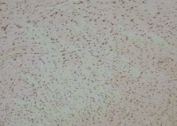 Invitrogen Phospho-Annexin A2 (Tyr24) Polyclonal Antibody 100 &mu;L; Unconjugated:Antibodies,
