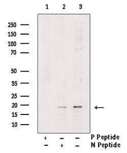 Invitrogen Phospho-PDCD5 (Ser119) Polyclonal Antibody 100 &mu;L; Unconjugated:Antibodies,
