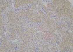 Invitrogen Phospho-PLD2 (Tyr511) Polyclonal Antibody 100 &mu;L; Unconjugated:Antibodies,