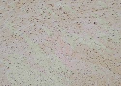 Invitrogen Phospho-MYPT1 (Ser299) Polyclonal Antibody 100 &mu;L; Unconjugated:Antibodies,