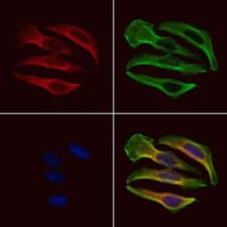 Invitrogen Phospho-MYPT1 (Tyr766) Polyclonal Antibody 100 &mu;L; Unconjugated:Antibodies,