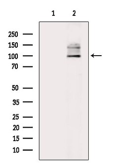 Invitrogen Phospho-MUSK (Tyr755) Polyclonal Antibody 100 μL; Unconjugated:Antibodies,