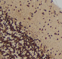Invitrogen Phospho-MUSK (Tyr755) Polyclonal Antibody 100 μL; Unconjugated:Antibodies,