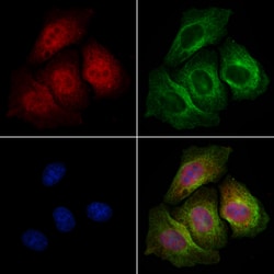 Invitrogen Phospho-MDMX (Ser367) Polyclonal Antibody 100 &mu;L; Unconjugated:Antibodies,