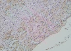 Invitrogen Phospho-SHIP2 (Tyr886) Polyclonal Antibody 100 μL; Unconjugated:Antibodies,