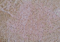 Invitrogen Phospho-FANCA (Ser1449) Polyclonal Antibody 100 &mu;L; Unconjugated:Antibodies,