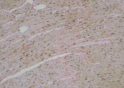 Invitrogen Phospho-FANCA (Ser1449) Polyclonal Antibody 100 &mu;L; Unconjugated:Antibodies,