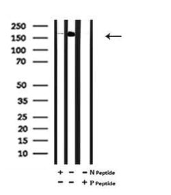 Invitrogen Phospho-FANCA (Ser1449) Polyclonal Antibody 100 &mu;L; Unconjugated:Antibodies,