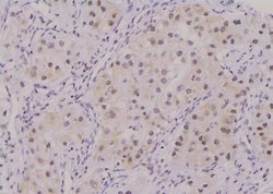 Invitrogen Phospho-Survivin (Thr48) Polyclonal Antibody 100 &mu;L; Unconjugated:Antibodies,
