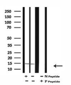 Invitrogen Phospho-Survivin (Thr48) Polyclonal Antibody 100 &mu;L; Unconjugated:Antibodies,