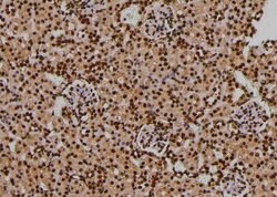 Invitrogen Phospho-PDPK1 (Thr245) Polyclonal Antibody 100 &mu;L | Buy Online | Invitrogen&trade; | Fisher Scientific