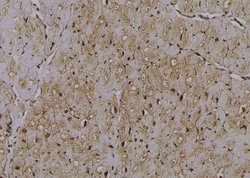 Invitrogen Phospho-RIP2 (Ser531) Polyclonal Antibody 100 &mu;L; Unconjugated:Antibodies,