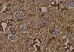 Invitrogen Phospho-RIP2 (Ser531) Polyclonal Antibody 100 &mu;L; Unconjugated:Antibodies,