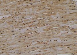 Invitrogen Phospho-RIP2 (Ser531) Polyclonal Antibody 100 &mu;L; Unconjugated:Antibodies,