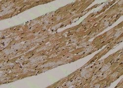 Invitrogen Phospho-RIP2 (Tyr381) Polyclonal Antibody 100 &mu;L; Unconjugated:Antibodies,