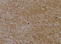 Invitrogen Phospho-RIP2 (Tyr381) Polyclonal Antibody 100 &mu;L; Unconjugated:Antibodies,