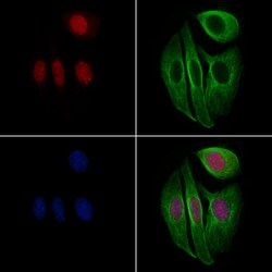 Invitrogen Phospho-FOXO3A (Ser284) Polyclonal Antibody 100 μL; Unconjugated:Antibodies,