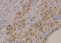 Invitrogen Phospho-FOXO3A (Ser284) Polyclonal Antibody 100 μL; Unconjugated:Antibodies,