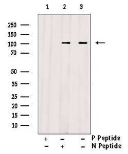 Invitrogen Phospho-FOXO3A (Ser284) Polyclonal Antibody 100 μL; Unconjugated:Antibodies,
