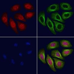 Invitrogen Phospho-FoxO3a (Ser644) Polyclonal Antibody 100 &mu;L; Unconjugated:Antibodies,