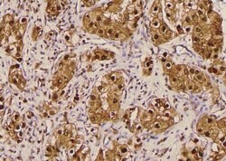 Invitrogen Phospho-FoxO3a (Ser644) Polyclonal Antibody 100 &mu;L; Unconjugated:Antibodies,