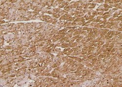 Invitrogen Phospho-FoxO3a (Ser644) Polyclonal Antibody 100 &mu;L; Unconjugated:Antibodies,