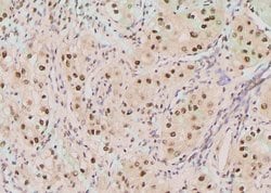 Invitrogen Phospho-SGTA (Ser301) Polyclonal Antibody 100 &mu;L; Unconjugated:Antibodies,