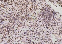 Invitrogen Phospho-DOK2 (Tyr402) Polyclonal Antibody 100 μL; Unconjugated:Antibodies,