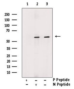 Invitrogen Phospho-DOK2 (Tyr402) Polyclonal Antibody 100 μL; Unconjugated:Antibodies,
