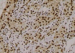 Invitrogen Phospho-delta Catenin (Tyr280) Polyclonal Antibody 100 &mu;L;