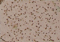 Invitrogen Phospho-delta Catenin (Tyr280) Polyclonal Antibody 100 &mu;L;