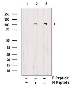 Invitrogen Phospho-delta Catenin (Tyr280) Polyclonal Antibody 100 &mu;L;