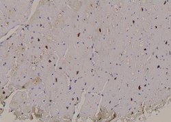 Invitrogen Phospho-PFKFB2 (Ser32) Polyclonal Antibody 100 &mu;L | Buy Online | Invitrogen&trade; | Fisher Scientific