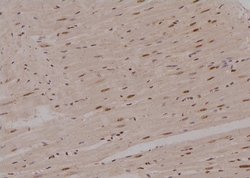 Invitrogen Phospho-PFKFB2 (Ser32) Polyclonal Antibody 100 &mu;L | Buy Online | Invitrogen&trade; | Fisher Scientific