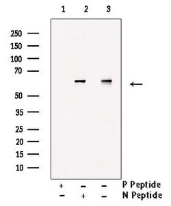 Invitrogen Phospho-PFKFB2 (Ser32) Polyclonal Antibody 100 &mu;L | Buy Online | Invitrogen&trade; | Fisher Scientific