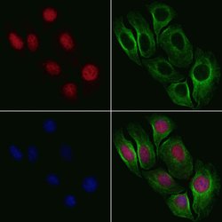 Invitrogen Phospho-NBS1 (Ser432) Polyclonal Antibody 100 &mu;L; Unconjugated:Antibodies,