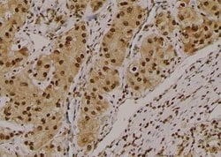 Invitrogen Phospho-NBS1 (Ser432) Polyclonal Antibody 100 &mu;L; Unconjugated:Antibodies,