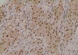 Invitrogen Phospho-ROCK2 (Ser1379) Polyclonal Antibody 100 &mu;L; Unconjugated:Antibodies,