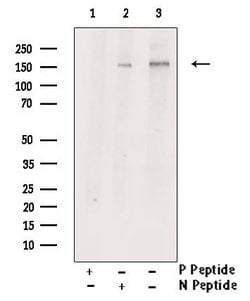 Invitrogen Phospho-ROCK2 (Ser1379) Polyclonal Antibody 100 &mu;L; Unconjugated:Antibodies,