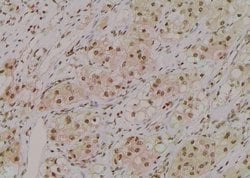 Invitrogen Phospho-ROCK2 (Ser1366) Polyclonal Antibody 100 μL; Unconjugated:Antibodies,