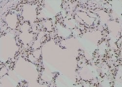 Invitrogen Phospho-ROCK2 (Ser1366) Polyclonal Antibody 100 μL; Unconjugated:Antibodies,
