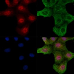 Invitrogen Phospho-ROCK2 (Ser1366) Polyclonal Antibody 100 μL; Unconjugated:Antibodies,