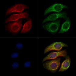 Invitrogen Phospho-ULK1 (Ser450) Polyclonal Antibody 100 &mu;L; Unconjugated:Antibodies,