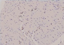 Invitrogen Phospho-ULK1 (Ser450) Polyclonal Antibody 100 &mu;L; Unconjugated:Antibodies,